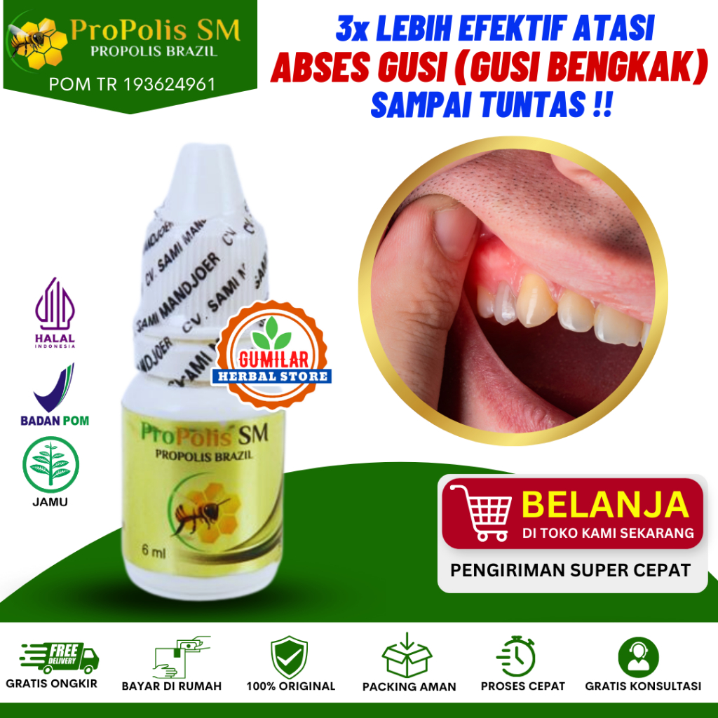 [BISA COD] Obat Tetes Abses Gusi , Obat Gusi Bernanah Radang Dan Nyeri Gusi , Obat Gusi Bengkak , Ob
