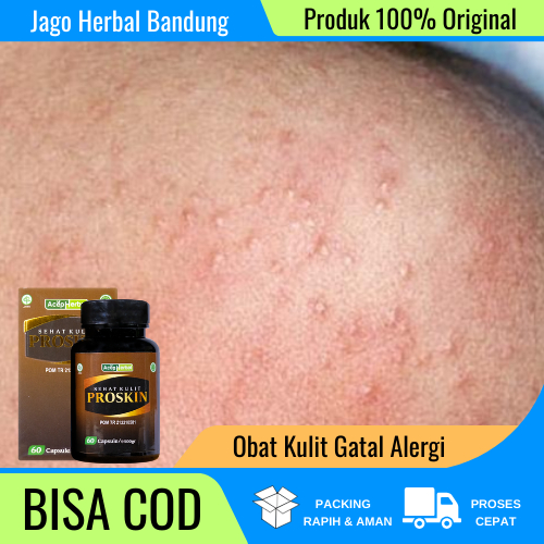 Obat Spesialis Kulit Gatal Alergi, Obat Gatal Alergi, Obat Gatal Alergi Bentol Kulit, Obat Gatal Ale