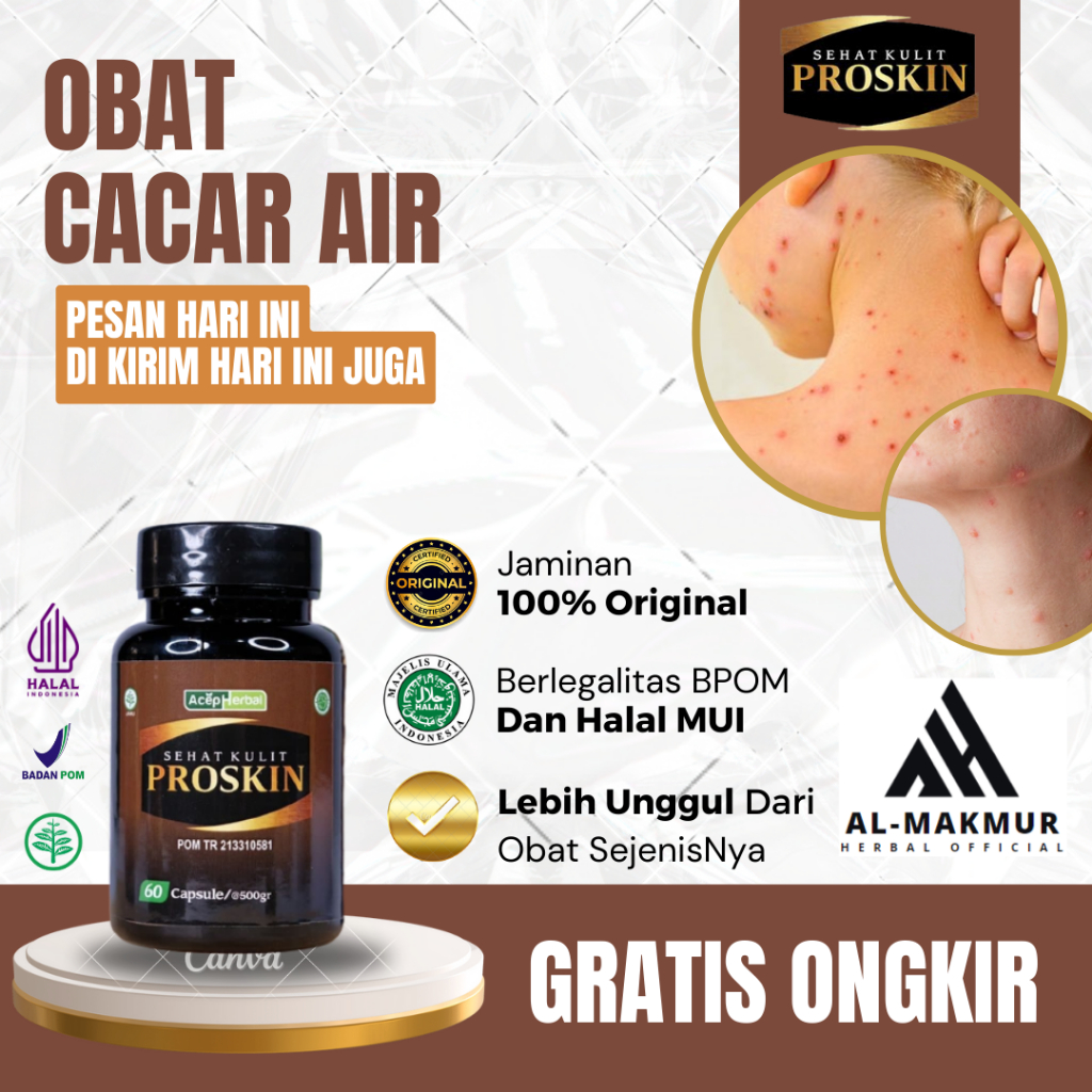 Obat Cacar Air, Obat Penghilang Bintik Berair, Obat Pengering Cacar Air, Obat Cacar Air Bernanah, Ob