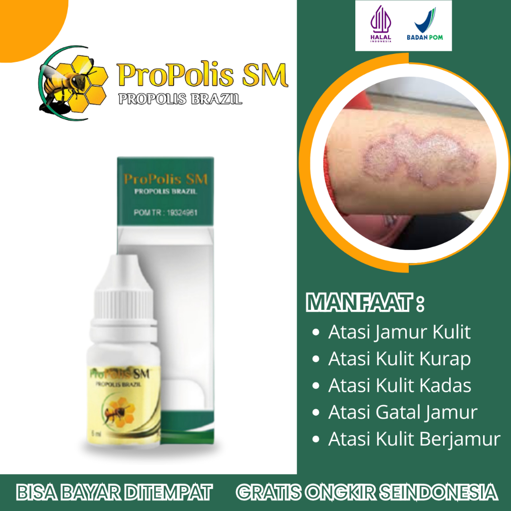 Obat Jamur Kulit, Obat Jamur di Selangkangan, Obat Jamut Kulit di Kepala, Obat Kulit Berjamur, Obat 