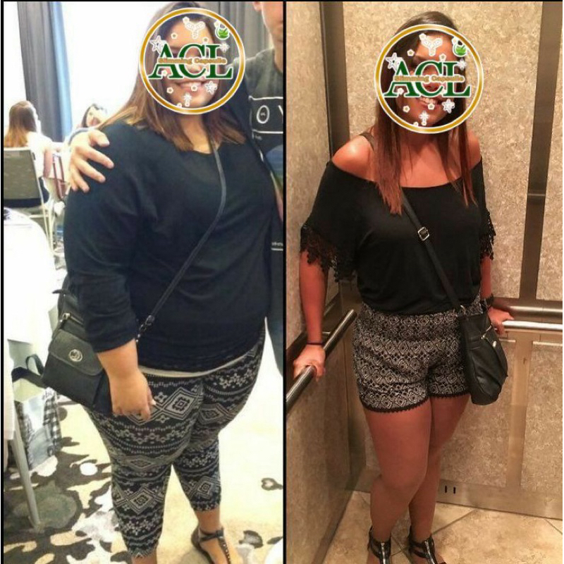 ACL Slimming Capsule  Isi 30 Kapsul Pelangsing Cepat Turun  Pil Pink Herbal Diet Aman Dan Ampuh Menu