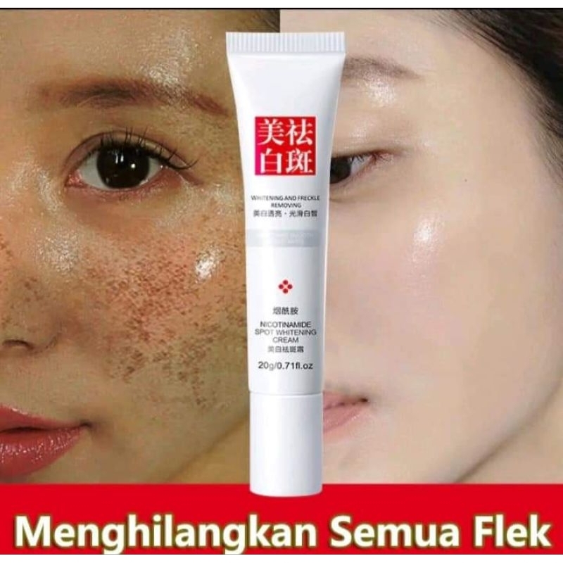 cream flek fuyan ampuh