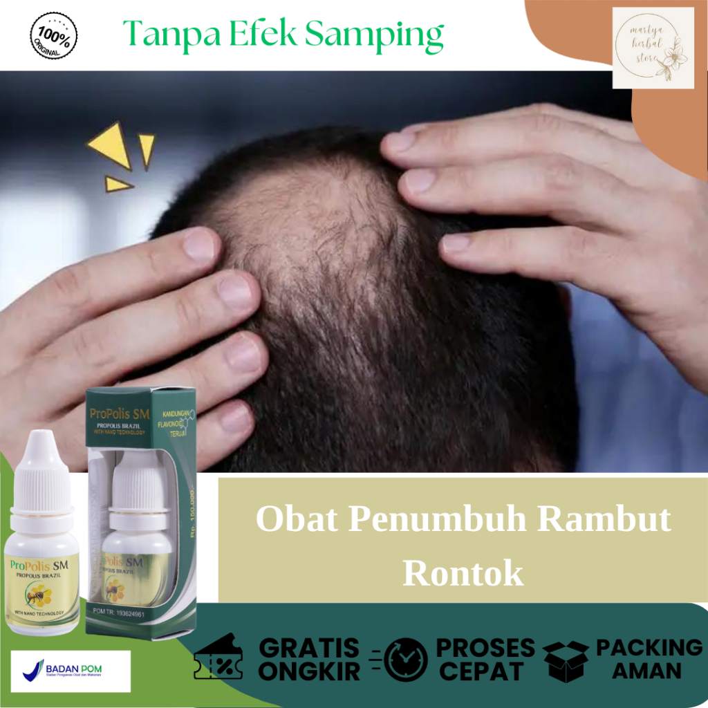 Obat Penumbuh Rambut Botak, Obat rambut rontok parah, Obat Untuk Rambut Rontok Parah, Obat Penumbuh 