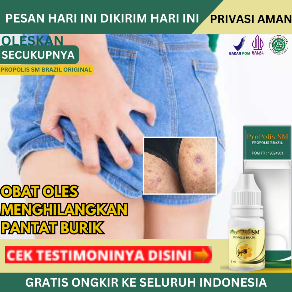 Obat Pantat Hitam, Obat Pantat Burik, Obat Pantat Gatal, Obat Koreng di Pantat, Obat Pantat Bruntusa