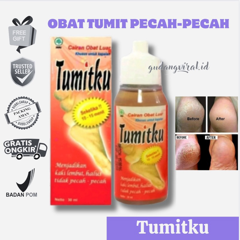❤️GV❤️ TUMITKU OBAT KAKI KAPALAN DAN PECAH PECAH SOLUSI KAKI KERING KAPALAN KASAR MENGATASI KAKI PEC