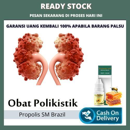 Obat Polikistik, Nyeri Ginjal, Ginjal, Gagal Ginjal, Ginjal Bocor, Batu Ginjal, Pembersih Ginjal, Si