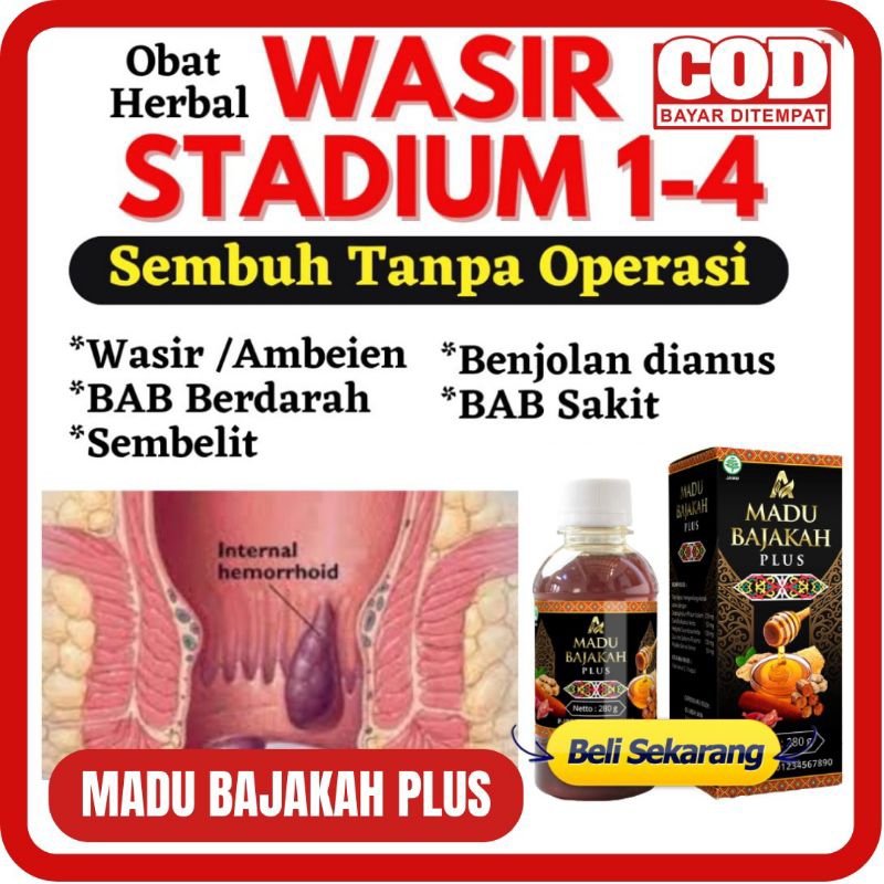 

MADU BAJAKAH PLUS ABABIL 280 GR MADU BAJAKAH ABABIL ATASI WASIR SEMBELIT BENJOLAN WASIR AMBEYEN AMBEIEN BAJAKAH BORNEO