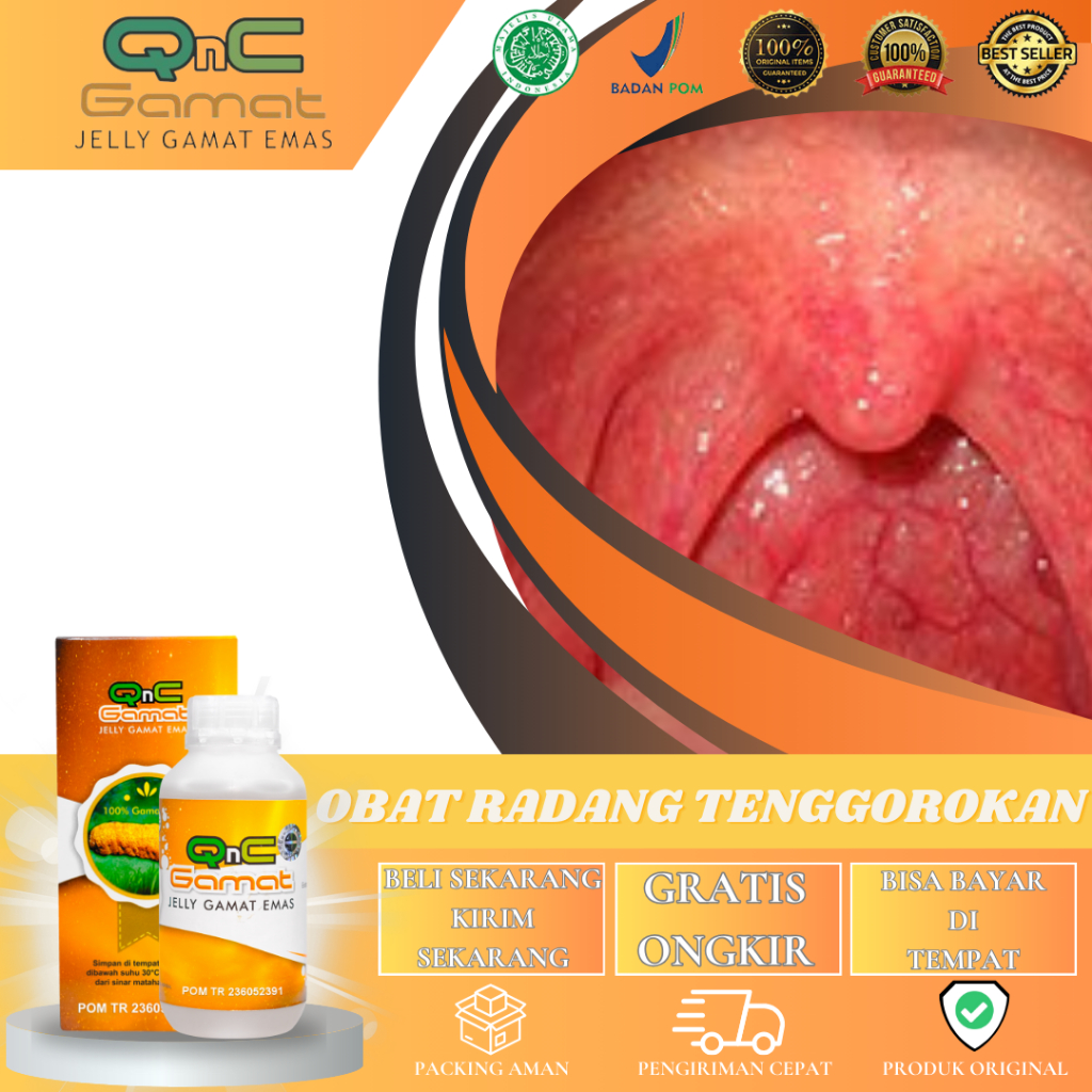 Obat Radang Tenggorokan Batuk Kering Sakit Tenggorokan Batuk Berdahak Susah Menelan Infeksi Tenggoro