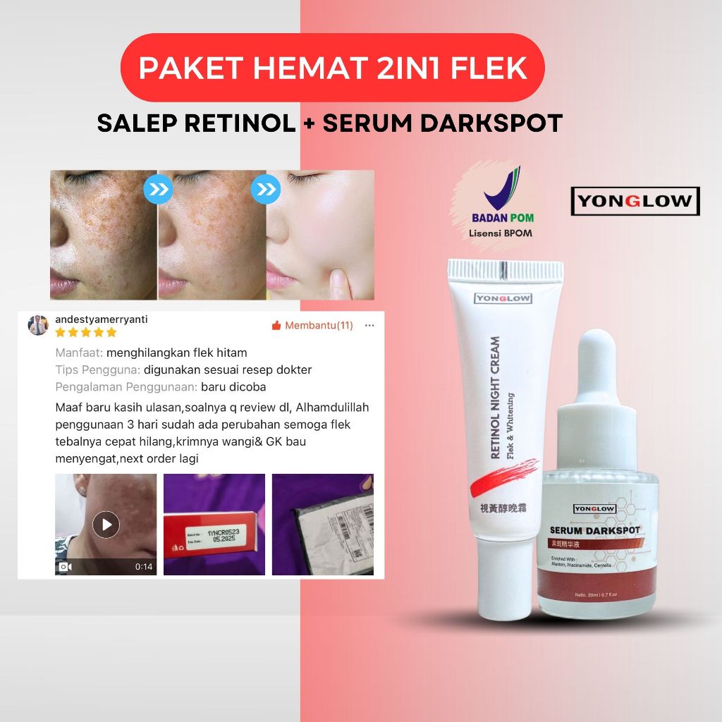 Paket 2in1 Salep Cina Yonglow Skincare Salep Retinol Serum Darkspot BPOM Salep Malam Flek Noda Hitam