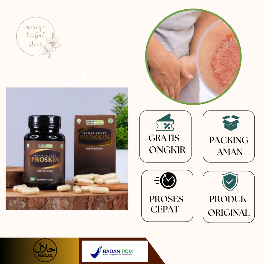 Sehat Kulit Proskin Obat Gatal Kulit, Obat Cacar Air, Obat Gatal Selangkangan, Obat Kutu Air, Obat  