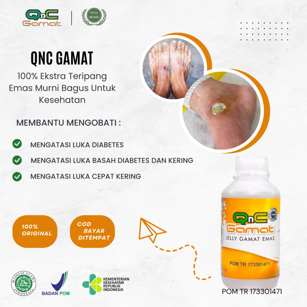 Obat Luka Diabetes Basah Bernanah, Obat Luka Diabetes Basah, Obat Pengering Luka Diabetes Basah, Oba