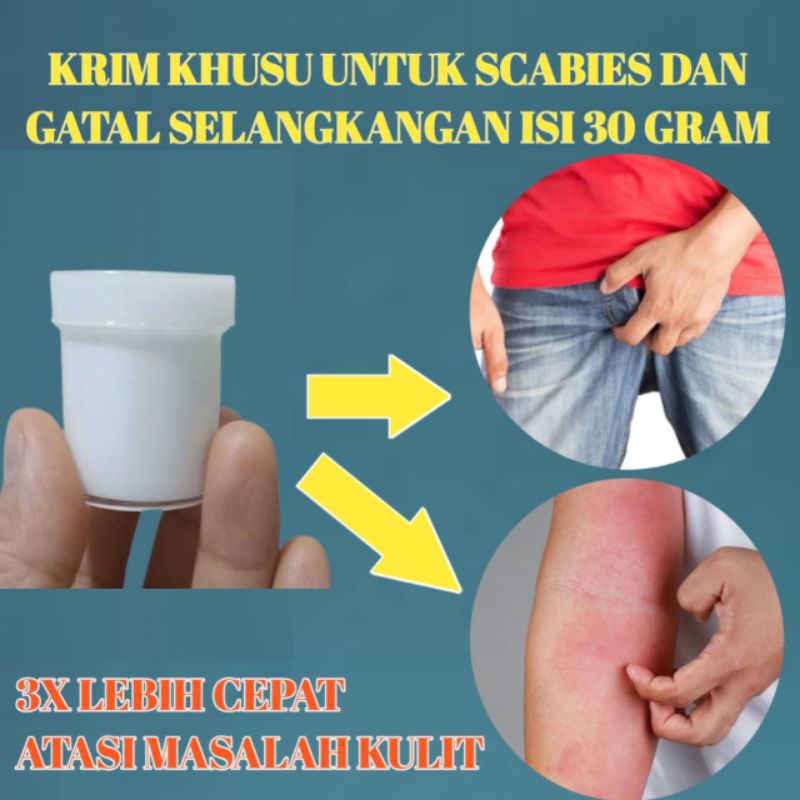 Salep serbaguna racikan apotek isi 20 gram paling ampuh untuk gatal selangkangan dan scabies