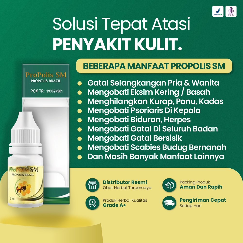 Obat Gatal Kulit Salep Eksim Exim Psoriasis Kepala Borok Infeksi Jamur Kurap Dingin Biduran Anak Ska