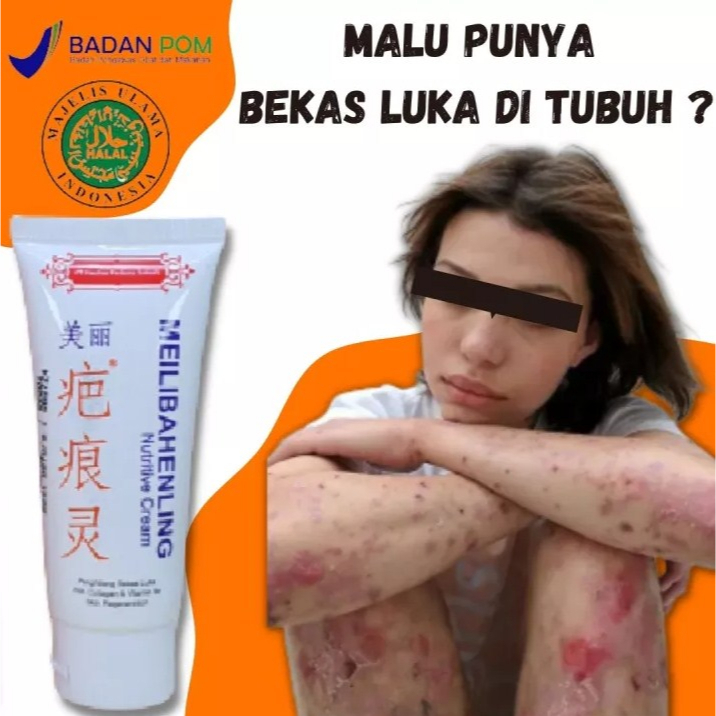 MEILIBAHENLING KRIM CREAM SALEP PENGHILANG BEKAS LUKA DI KULIT BEKAS LUKA BAYI ANAK DEWASA ORANG TUA