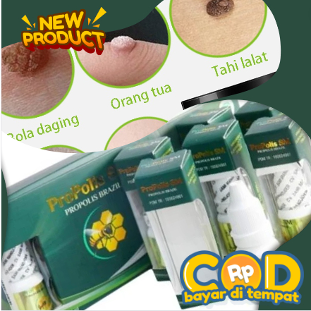 PROPOLIS SM Obat Oles Kutil Hpv Mata Ikan Tahi Tai Lalat Daging Tumbuh Skin Tag Papiloma Asli Penghi