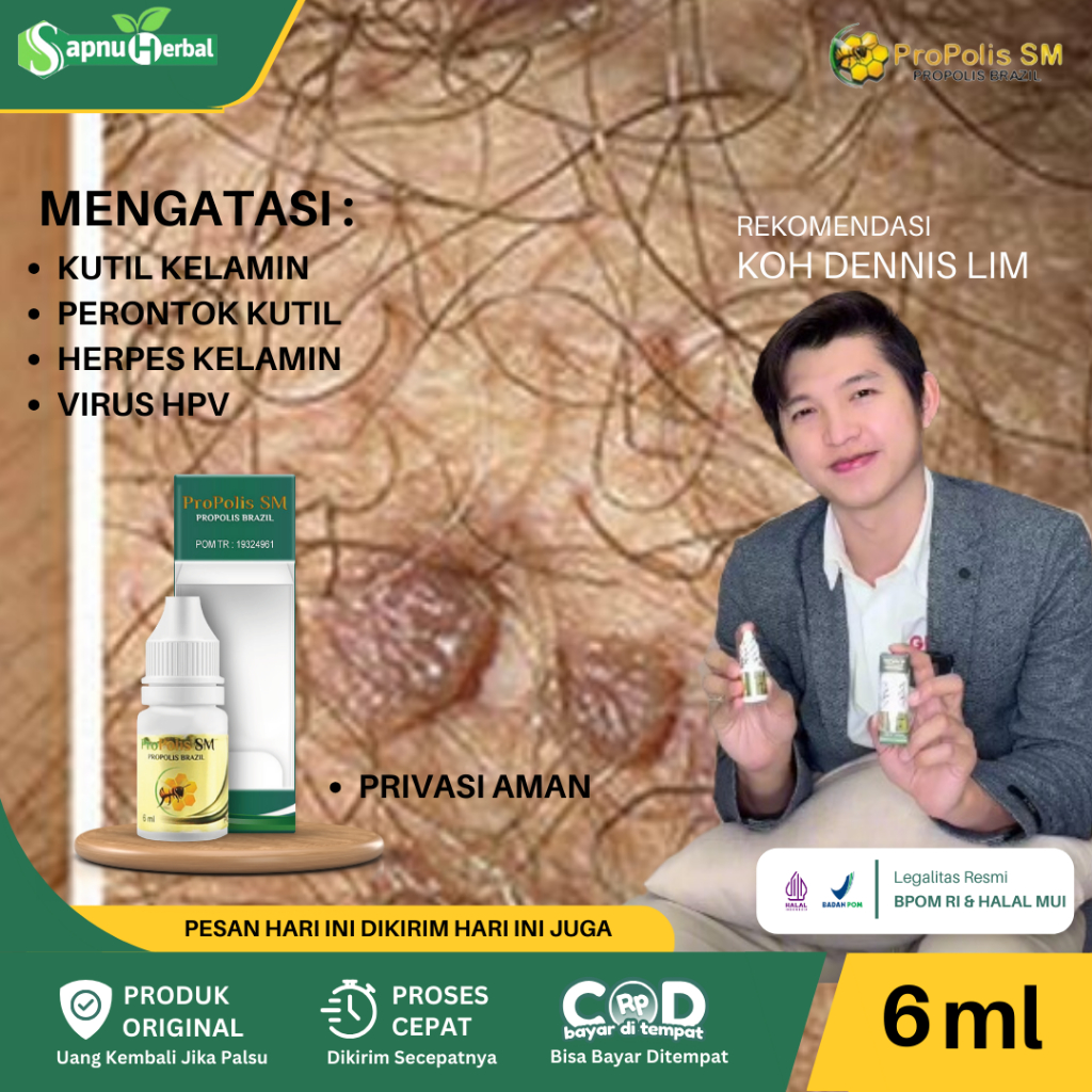 Obat Kutil Kelamin, Perontok Kutil, Penghilang Jengger Ayam, Daging Jadi di Kelamin, Benjolan Kelami