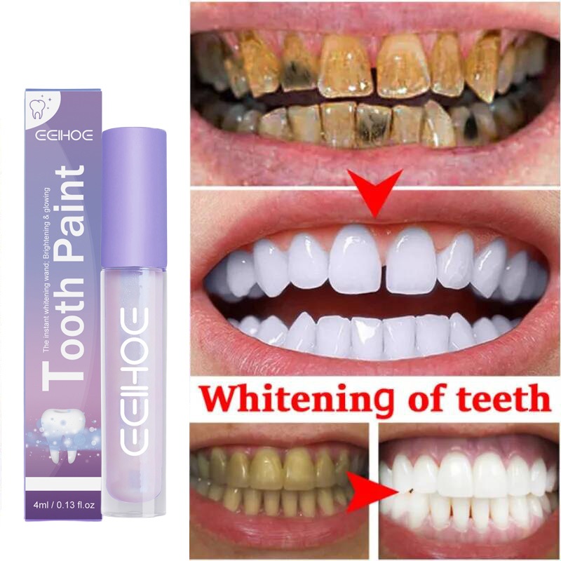 pemutih gigi kuning alat pemutih gigi teeth whitening gigi pemutih gigi Pena Esensi Pemutihan Gigi 7