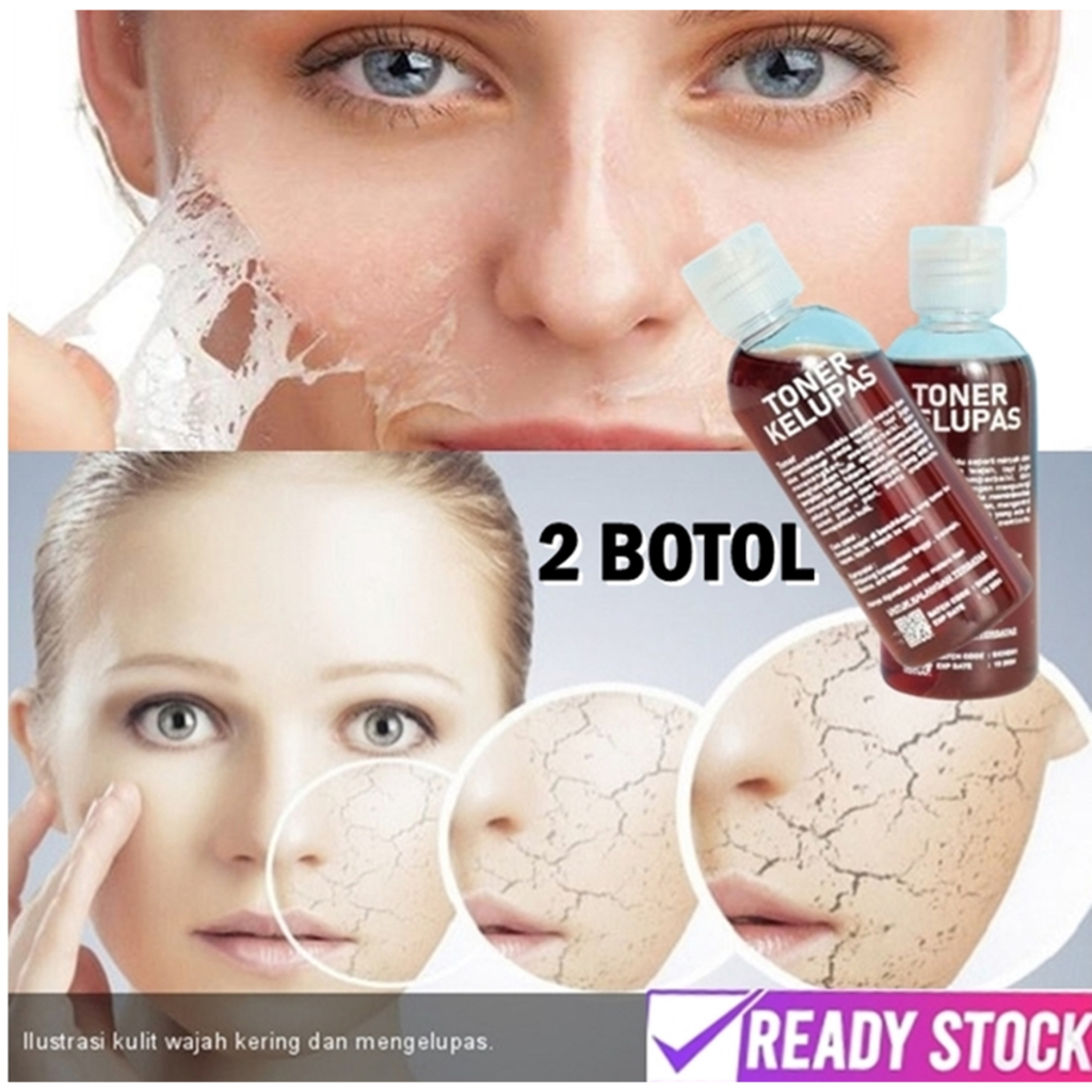 BPOM Toner Pengelupasan Wajah - 60ml / Toner Kelupas 60 ml / Toner Jerawat / Toner Flek / Toner Pemu