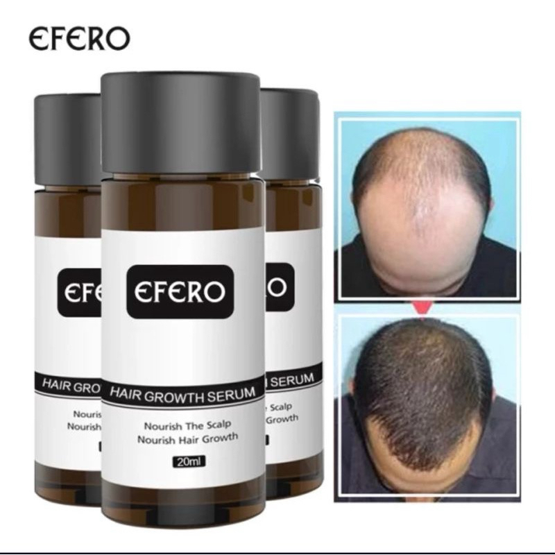 Efero Obat Penumbuh Rambut Botak Rontok / Brewok / Alis /Jenggot / Kumis / Efero Hair Growth Essenti