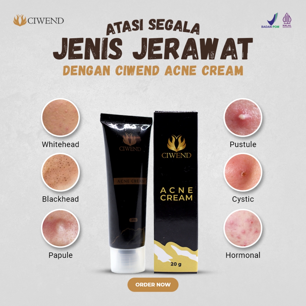 CIWEND ACNE CREAM SOLUSI JERAWAT & BRUNTUSAN