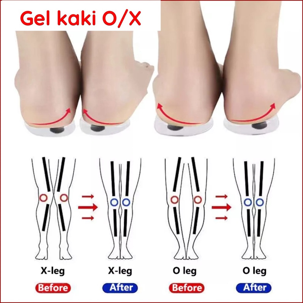 FYB323 Dijamin Ori INSOLE GEL SILIKON KAKI OX SOL SEPATU PERBAIKI KAKI OX PRIA WANITA OX