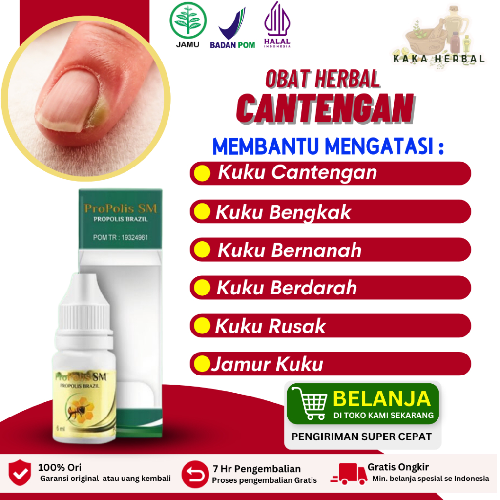 Kaka Herbal - Obat Cantengan Jempol Kuku Kaki Dan Tangan, Kuku Bengkak Bernanah Nyeri Bau Busuk, Oba