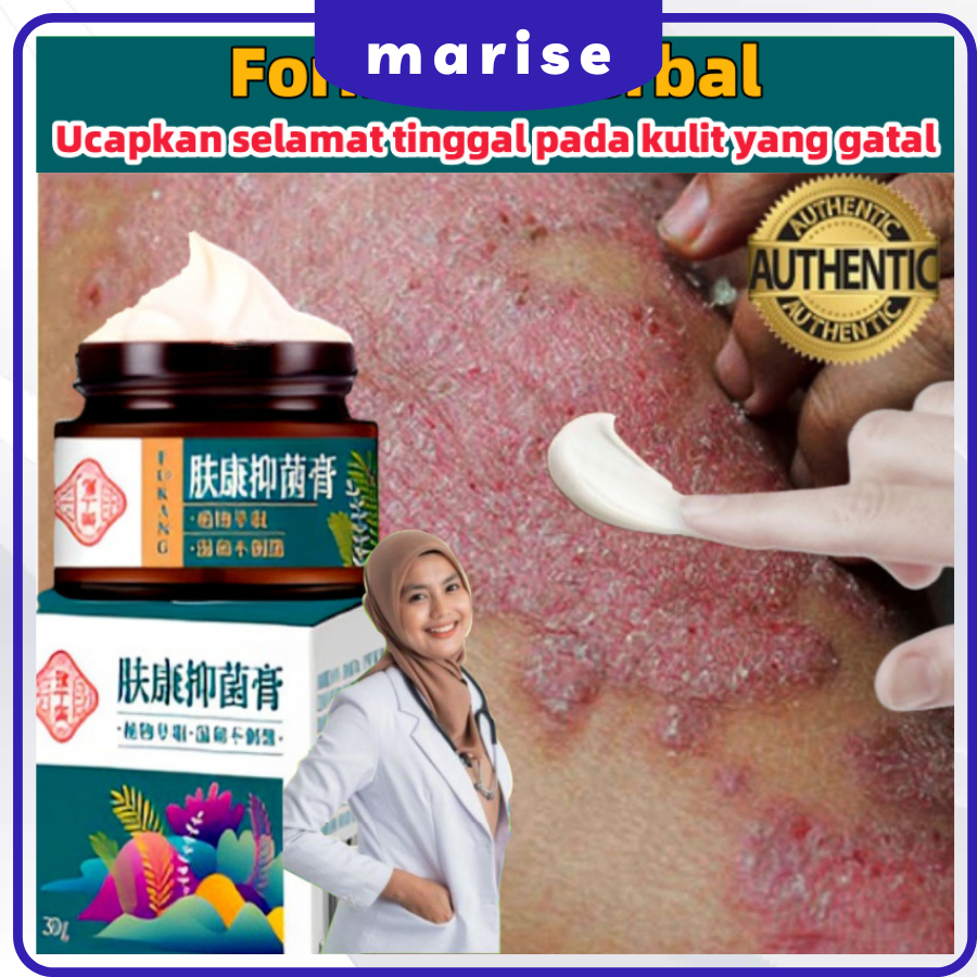 Salep gatal Salep psoriasis Cepat dan efektif Obat Gatal Pantat Dan Selangkangan Obat 30g Psoriasis 