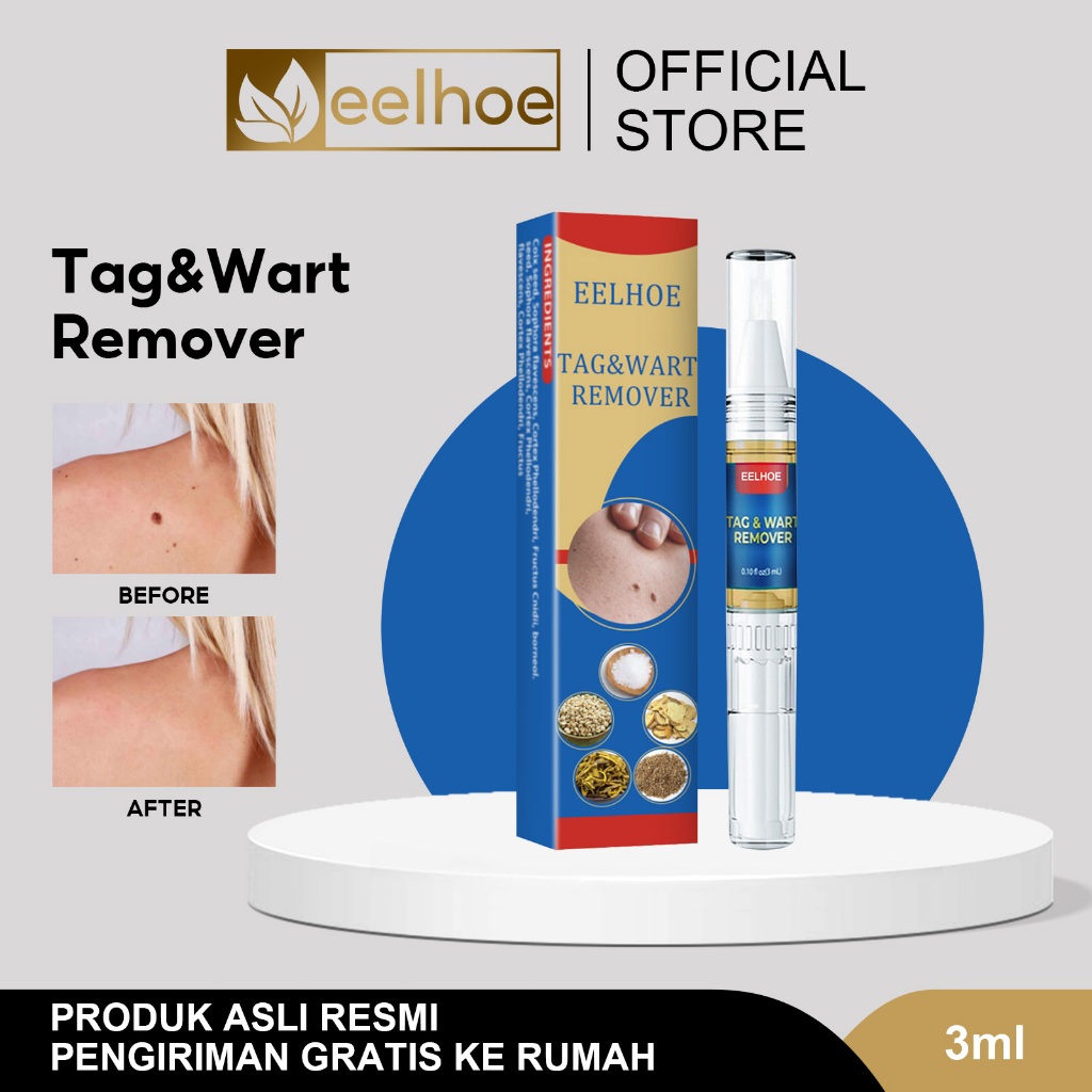 EELHOE Penghilang Kutil Wart Removal Pen Cream Krim Penghilang Lalat, Krim Penghilang Kutil, Mudah D
