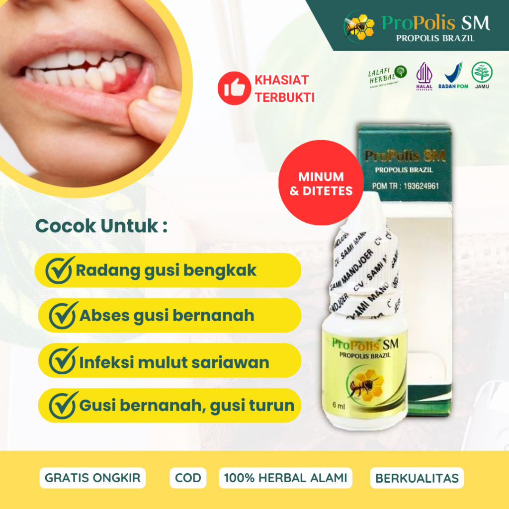 Obat Gusi Bengkak Bernanah Gigi Berlubang, Radang Gusi Berdarah, Gusi Turun, Infeksi Mulut Luka Sari