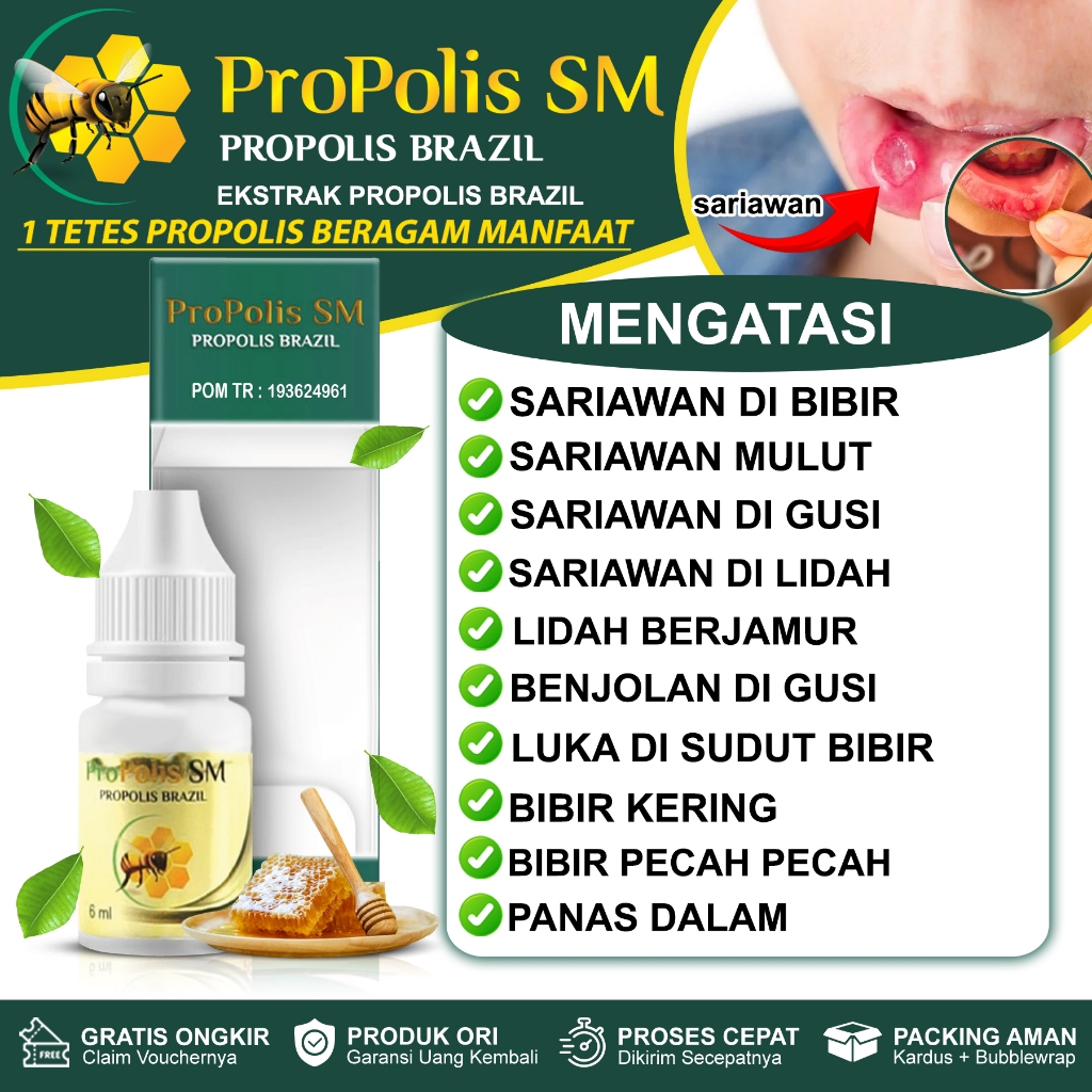 Obat Sariawan Di Bibir Mulut Dan Lidah Sariawan Di Gusi Lidah Berjamur Benjolan Di Gusi Bibir Kering