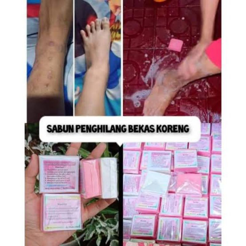 Promo..!! Sabun Viral Susu Collagen Pemutih Tubuh/Penghilang Koreng Ampuh/Sabun Pemutih Susu Viral