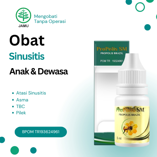 Obat Sinusitis Herbal Tetes Anak Dan Dewasa 6 ml