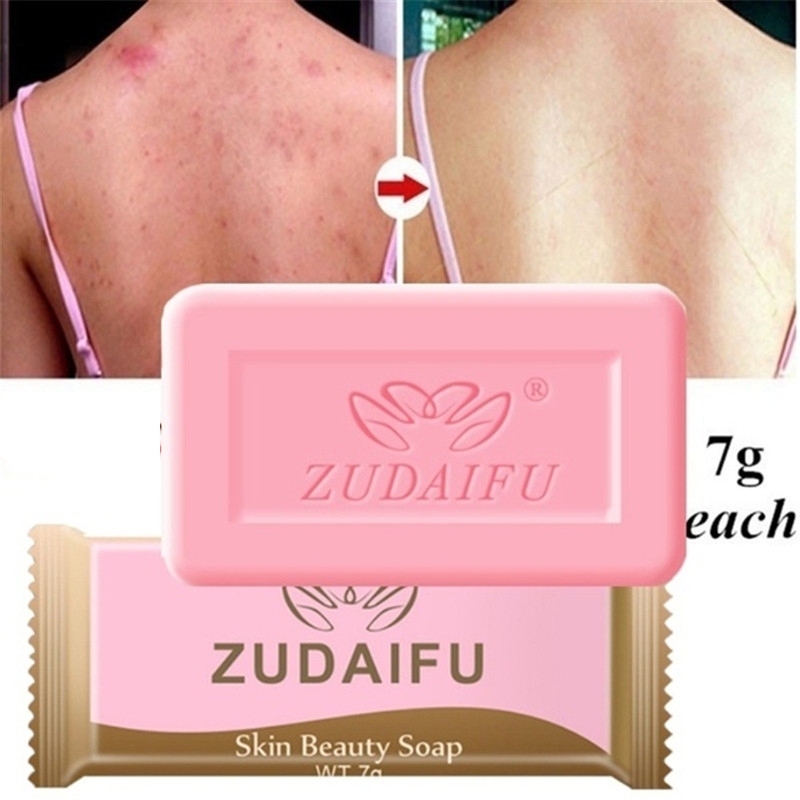 Skin Beauty Soap Sabun Jerawat Eksim Psoriasis Jamur
