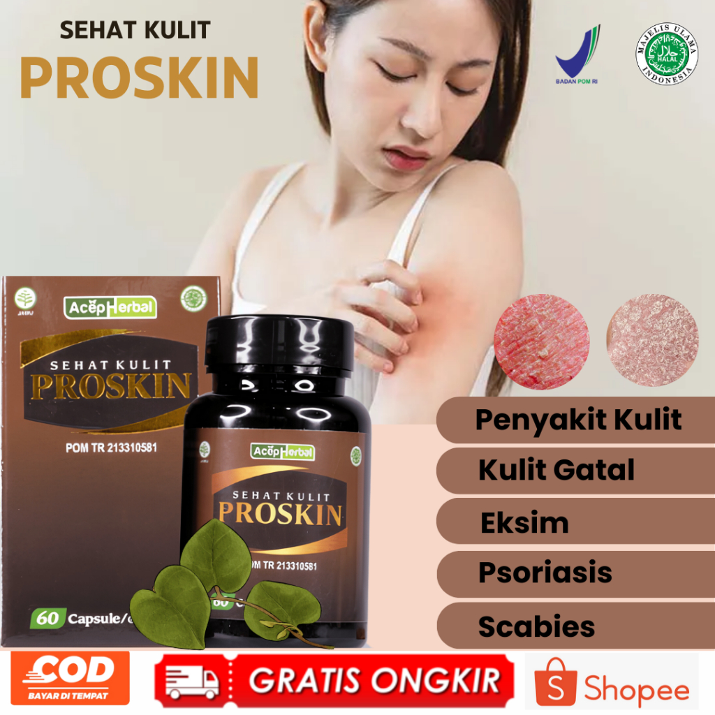 Obat Eksim Gatal-Gatal Eksim Basah Eksim Kering Eksim Menahun Ruam Gatal Proskin Ekstrak Binahong