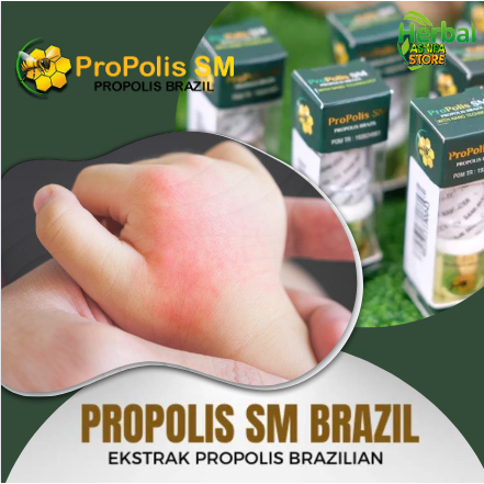 Obat Penghilang Gatal-gatal Gatel pada Kaki, Pantat, Tangan anak, Obat Herbal Ruam Popok, Dermatitis