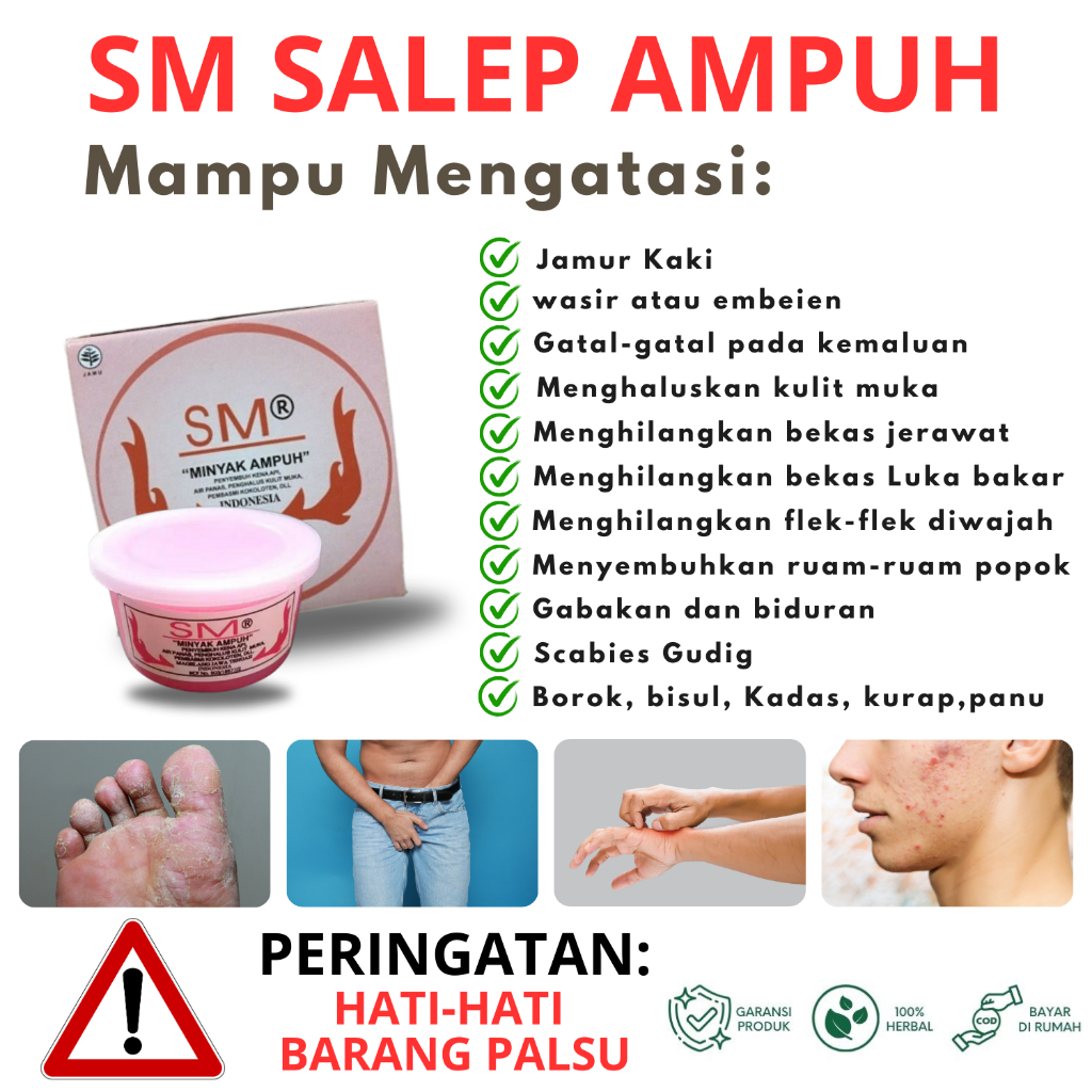 Terlaris minyak ampuh sm | SM minyak ampuh | obat ruam | obat jerawat | salep | MINYAK AMPUH SM |SM 