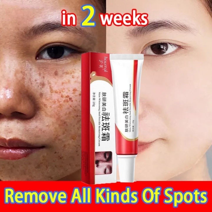 100% Original Niacinamide Whitening Freckle Removal Cream Dark Spots Remove Cream,Blemish Removal Ge