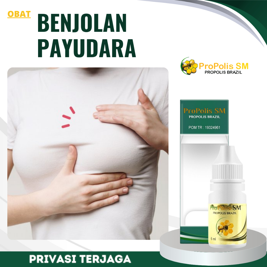 Obat Penghancur Benjolan Di Payudara, Obat Tumor payudara, Obat Kista Payudara, Obat Infeksi Payudar