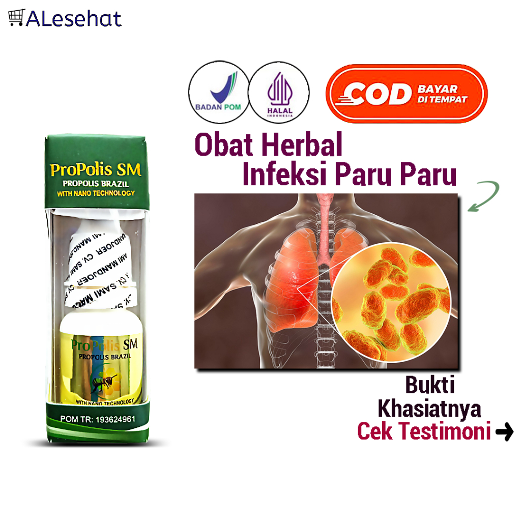 Obat Infeksi Paru paru Dewasa atau Anak Propolis SM