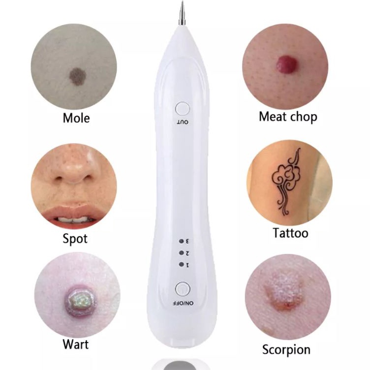 alat laser penghilang flek bintik hitam tahi lalat karang tato tatoo scar kutil jerawat dark spot mo