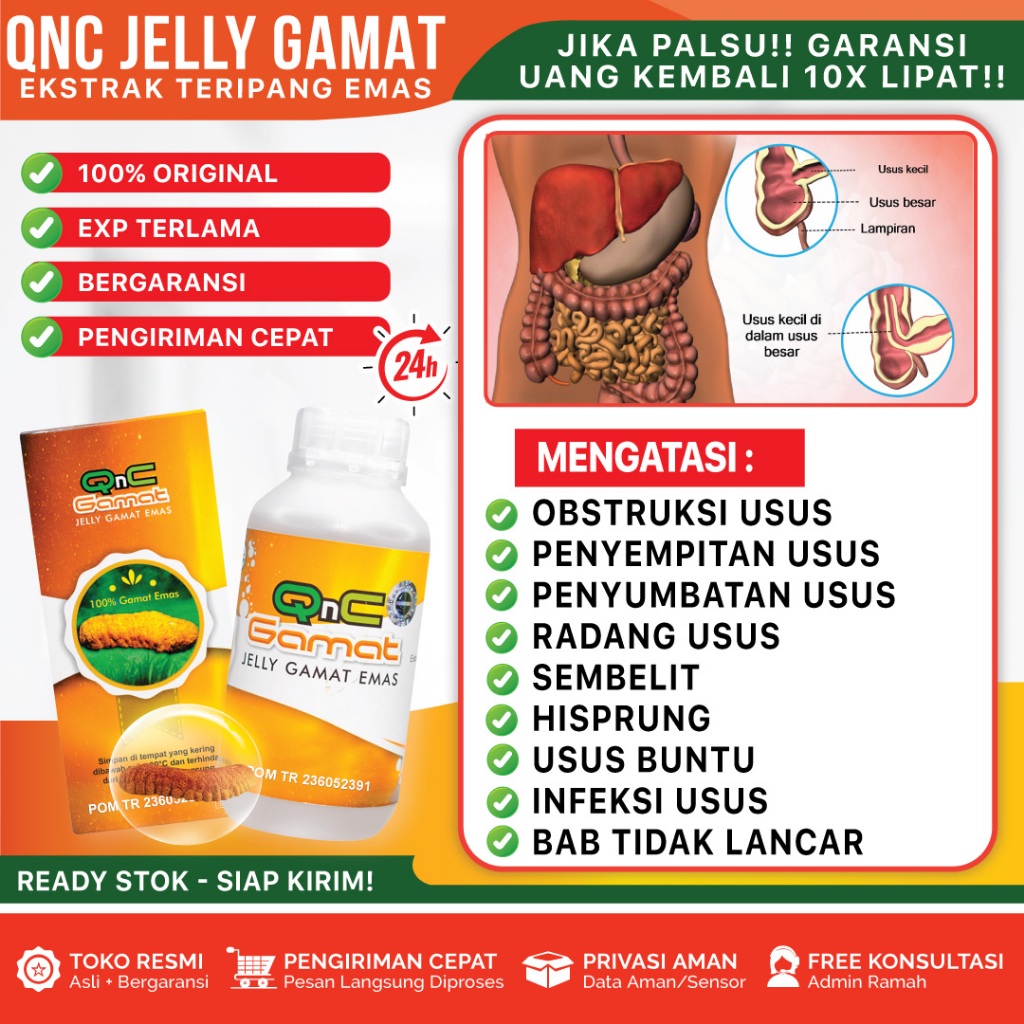 Obat Obstruksi Usus, Penyempitan/Penyumbatan Usus, BAB Tidak Lancar, Sembelit, Hisprung, Radang Usus