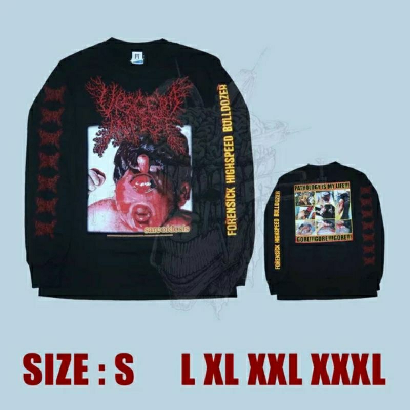 LS - VISCERA INFEST - Sarcoidosis