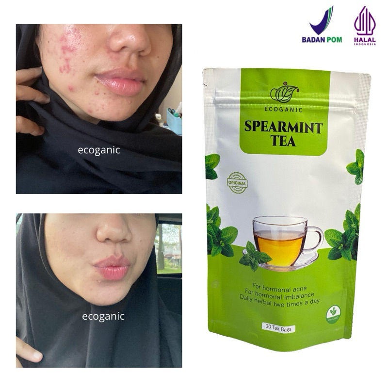 

Original Spearmint Tea BPOM P-IRT Jerawat Hormonal Isi 30 Kantong | Hempas minyak di wajah | Untuk nyeri Haid | COD Makassar Distributor Resmi