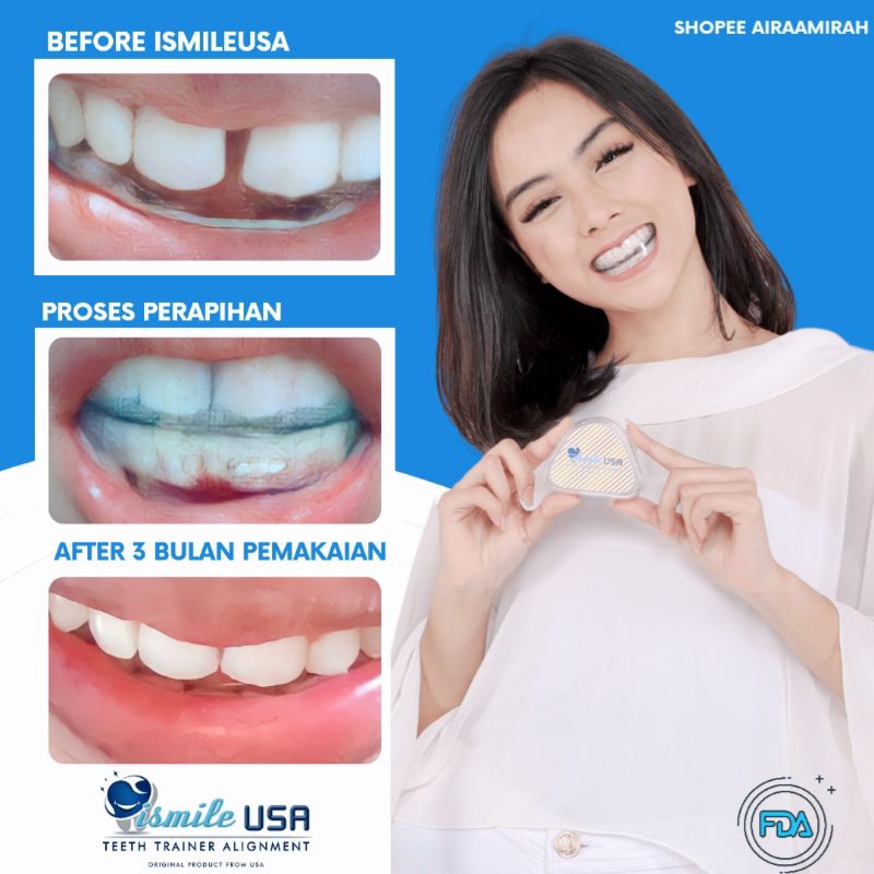 Perapih gigi Ismile USA original 100% garansi / Perapih gigi Ismile USA Original / Perapi gigi Ismil