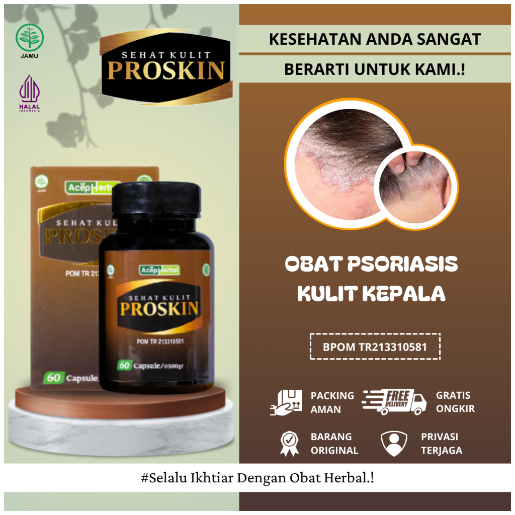 Obat Psoriasis Kulit Kepala, Obat Kulit Kepala Gatal dan Berkerak, Obat Kulit Kepala Psoriasis Menah