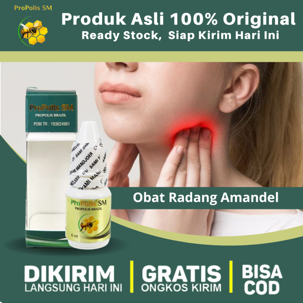 Obat Amandel Akut, Pengempes Amandel, Amandel Bengkak, Radang Amandel - Propolis SM Herbal Alami