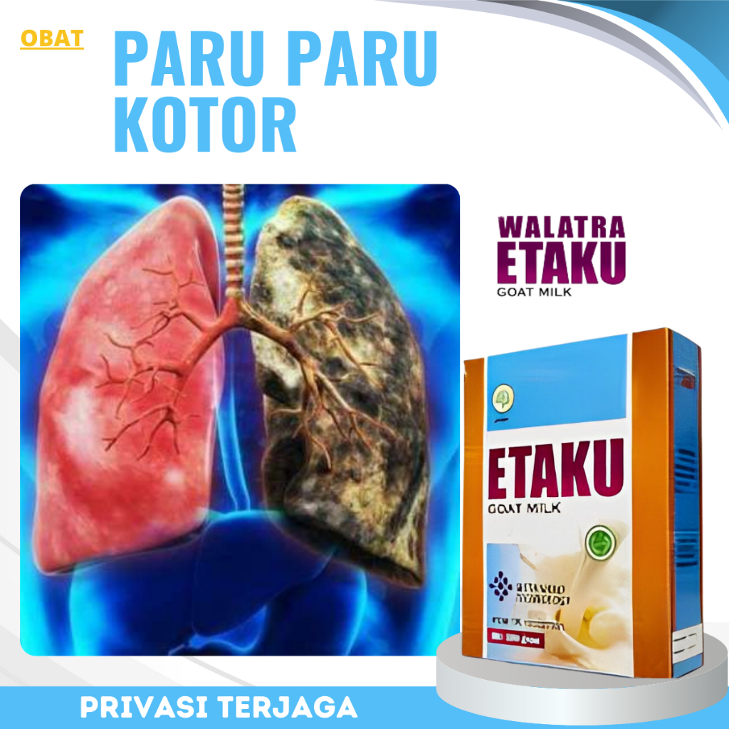

Susu Pembersih Paru Paru Kotor, susu Pembersih flek paru paru, Susu Untuk Radang Paru Paru, Infeksi Paru Paru, Asma, sesak nafas, Tbc, Nyeri Dada, Pembersih Paru Paru Perokok - Walatra Etaku Goat Milk