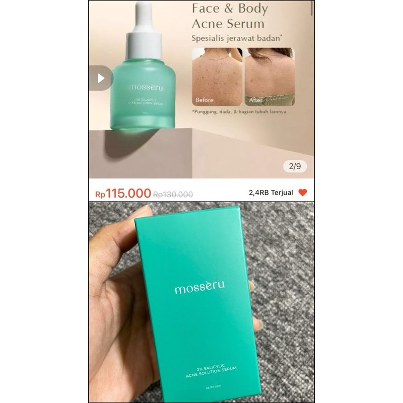 mosseru serum acne