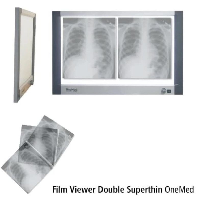 Film Viewer Double Superthin ONEMED - X-RAY Viewer Double Lampu Baca Rontgen Ronsen LED ONEMED XRAY 