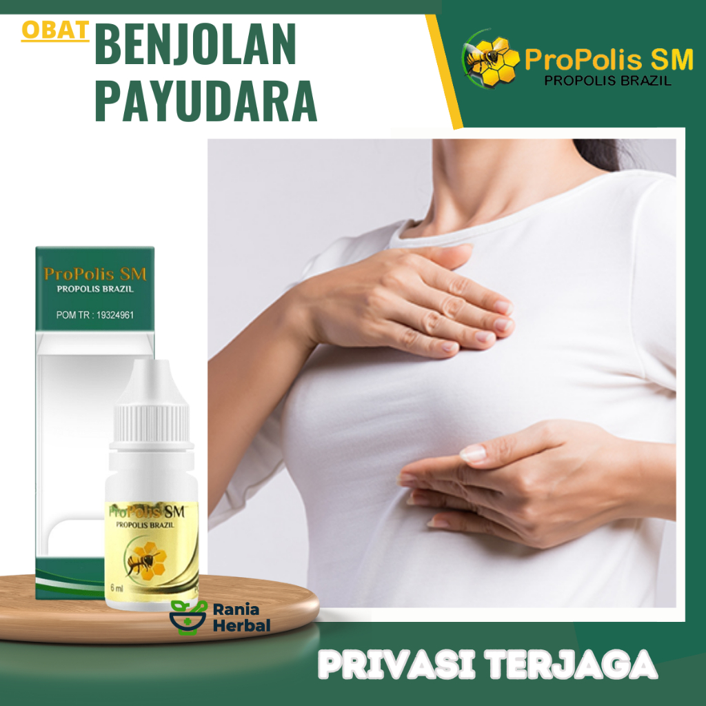 Obat Benjolan Payudara, Obat Kista Payudara Nyeri Payudara, Tumor Payudara, Obat Infeksi Payudara, O